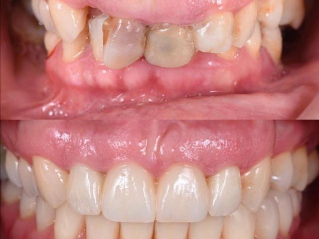 Dental Concept