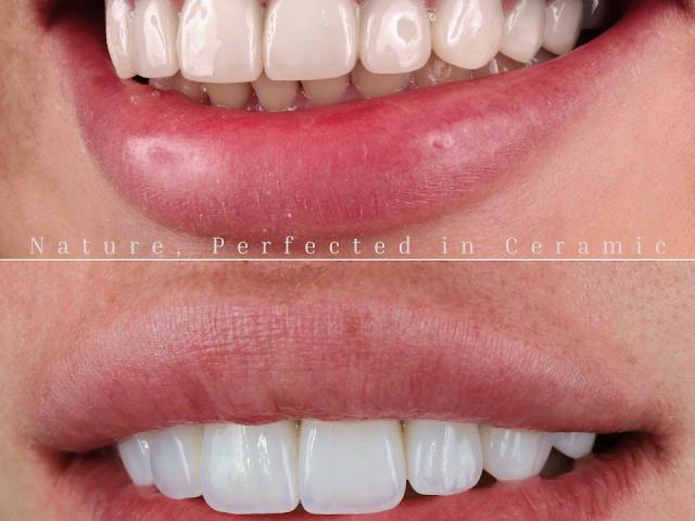 Meladze Dental Clinic