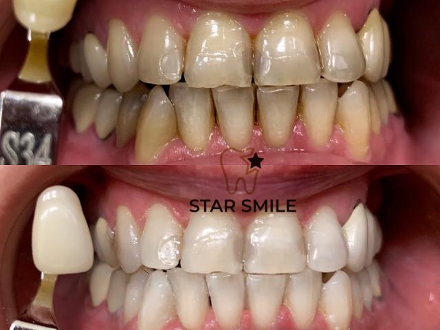 STAR SMILE