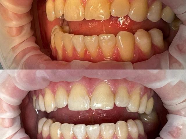 Стоматологія Старий Самбір"Burmych dental clinic"