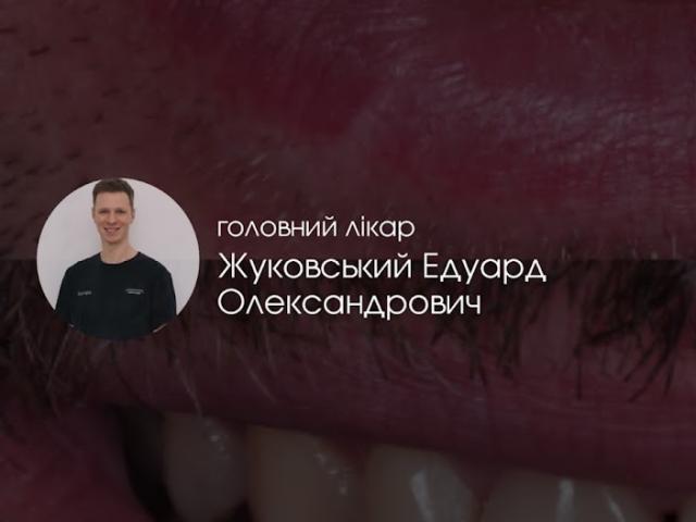ZHUKOVSKYI dental clinic