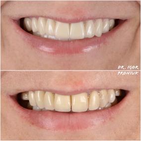I&I Dent photo
