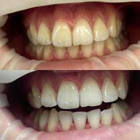 Kovmir Dental Clinic photo