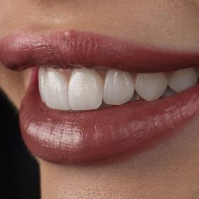 Molecule Dental Clinic