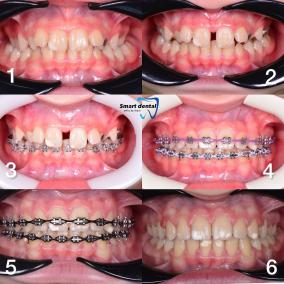 Smart Dental - стоматологія photo