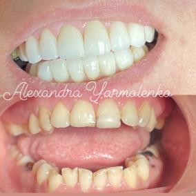 Стоматологія ALEKSA DENTAL photo