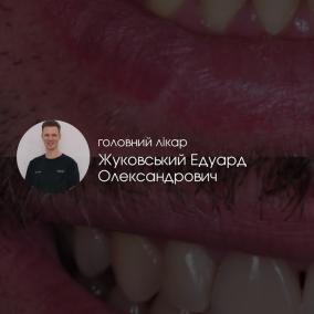 ZHUKOVSKYI dental clinic photo