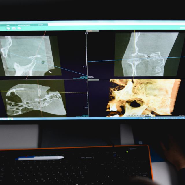 Diagnostic Center - стоматологічна рентген діагностика в Одесі photo