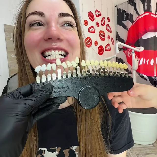 Smile bar Студія косметичного відбілювання зубов(не стоматология) photo