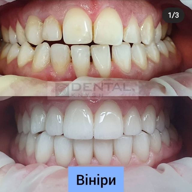 Стоматологія DentalKnysh photo
