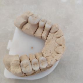 DentalLux