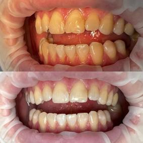 Стоматологія Старий Самбір"Burmych dental clinic"