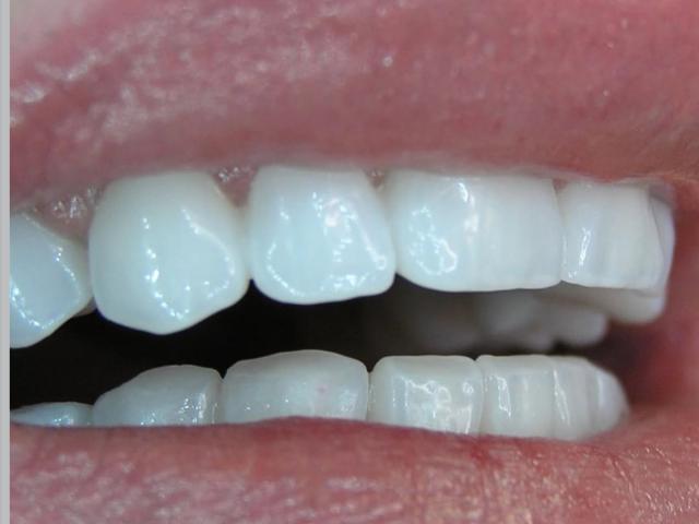 ADS "Andrusyshyn Dental Service"