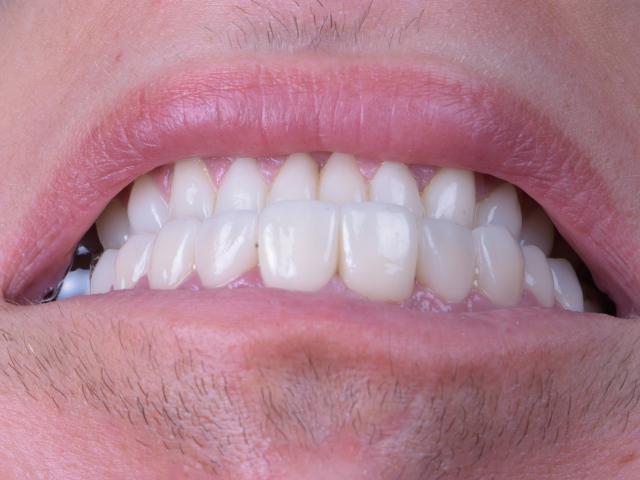 Dental Beauty Centre