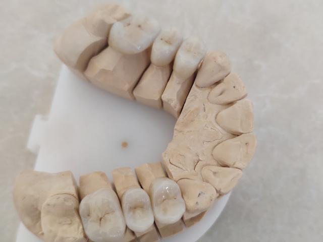 DentalLux