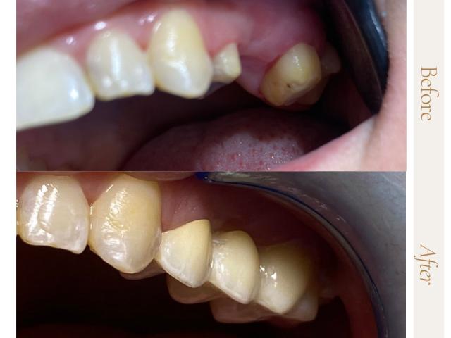 DentalWay