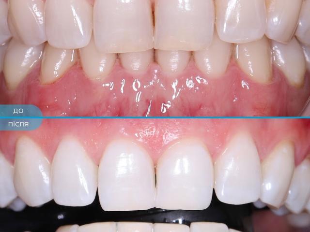 Happy Dental Clinic - Стоматология в Запорожье