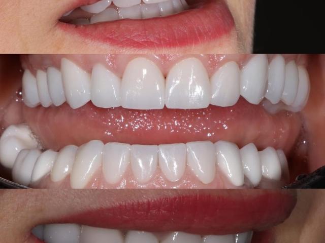 Herbei Dental Clinic