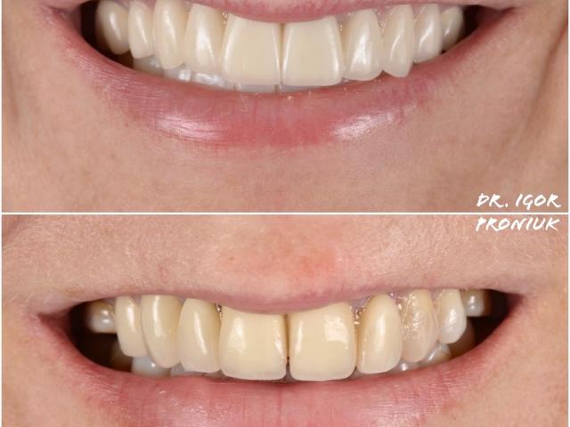 I&I Dent