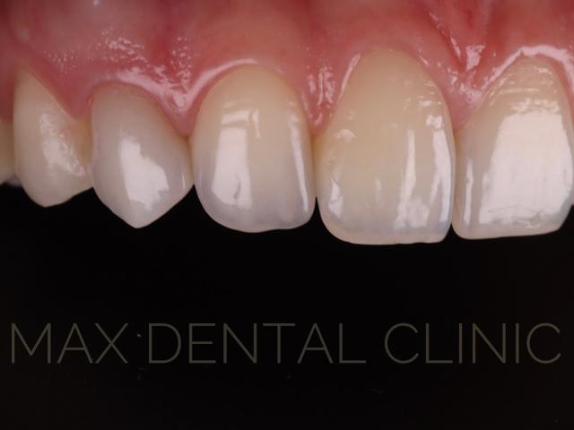 Max Dental Clinic
