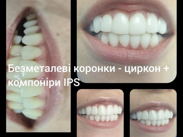 НянькінДент