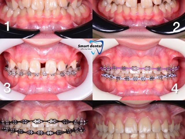 Smart Dental - стоматологія