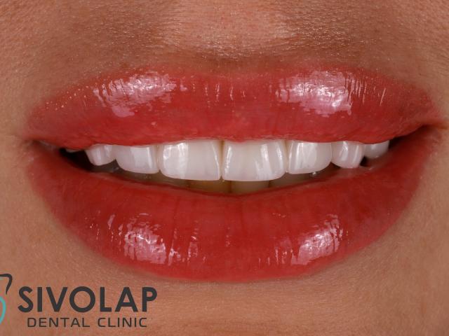 Стоматологічна клініка Sivolap Dental Clinic