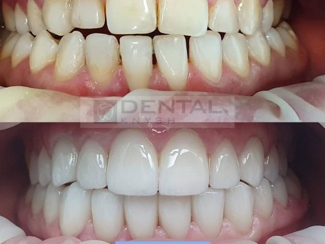 Стоматологія DentalKnysh