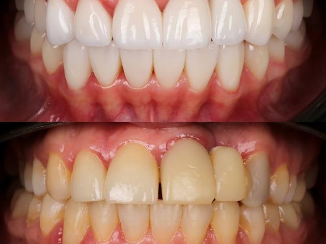 Стоматологія Odesa’s First Private Dental Center
