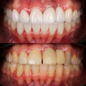 Стоматологія Odesa’s First Private Dental Center photo