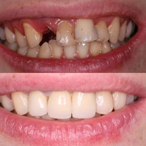 Denta Vita