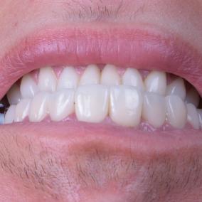 Dental Beauty Centre