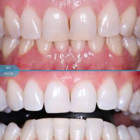 Happy Dental Clinic - Стоматология в Запорожье