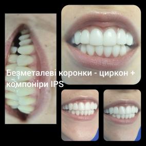 НянькінДент