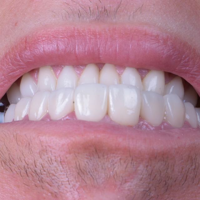 Dental Beauty Centre