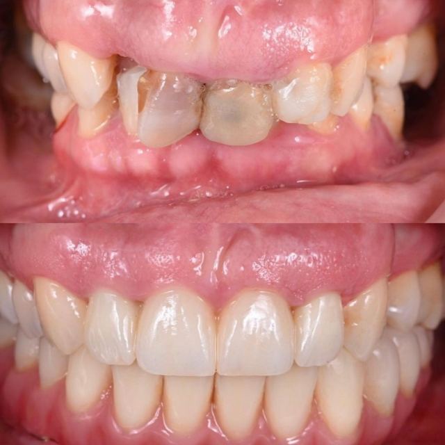 Dental Concept