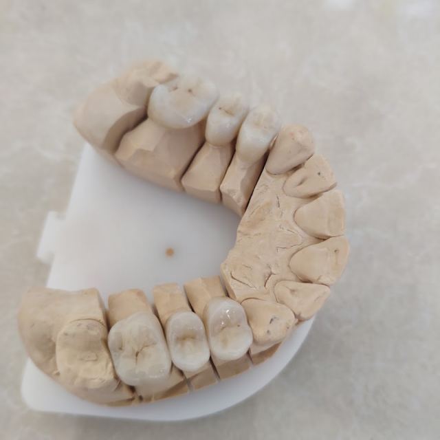 DentalLux