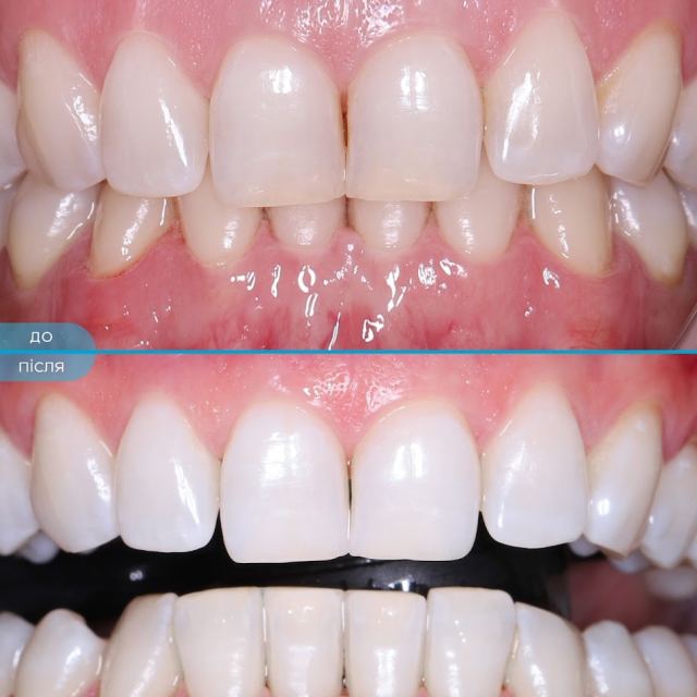 Happy Dental Clinic - Стоматология в Запорожье
