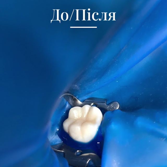 Ldent стоматологія