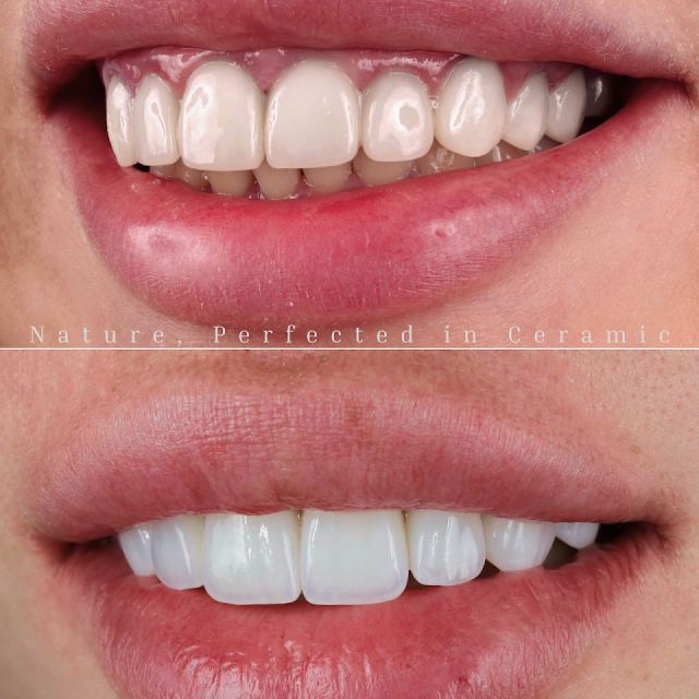 Meladze Dental Clinic