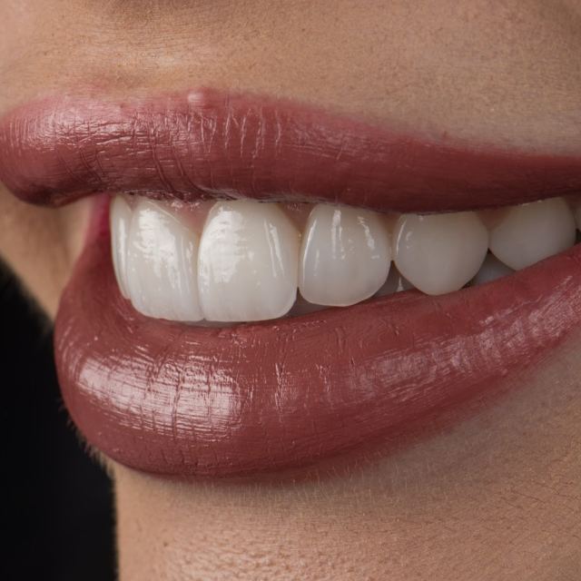 Molecule Dental Clinic