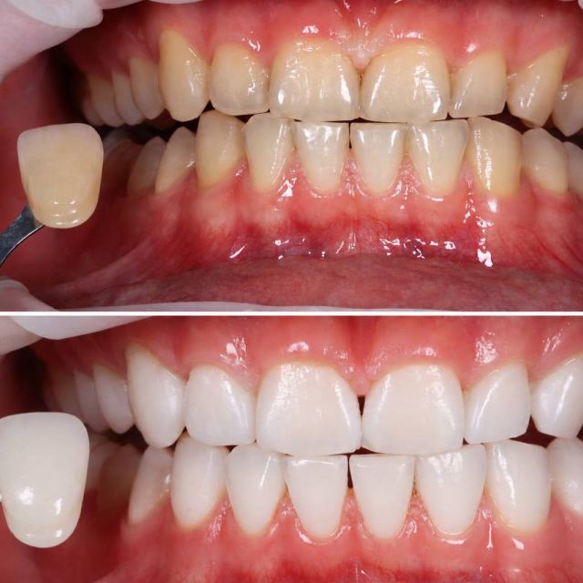 PRESTIGE DENT