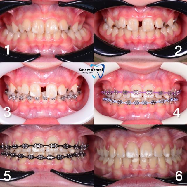 Smart Dental - стоматология