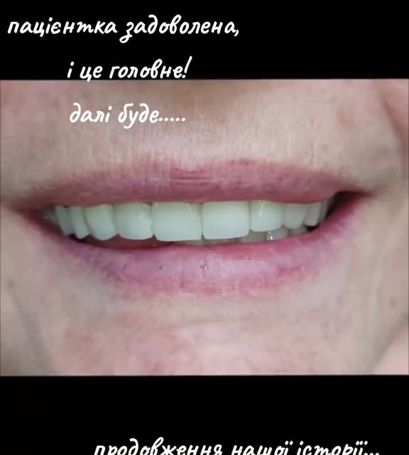 Стоматологія LikeDent