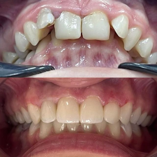 Стоматологія Lysko dental