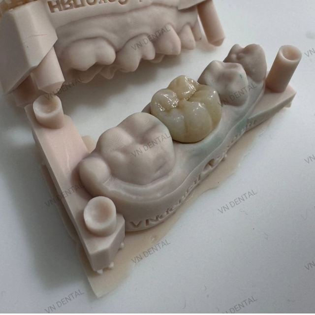 VN Dental Clinic